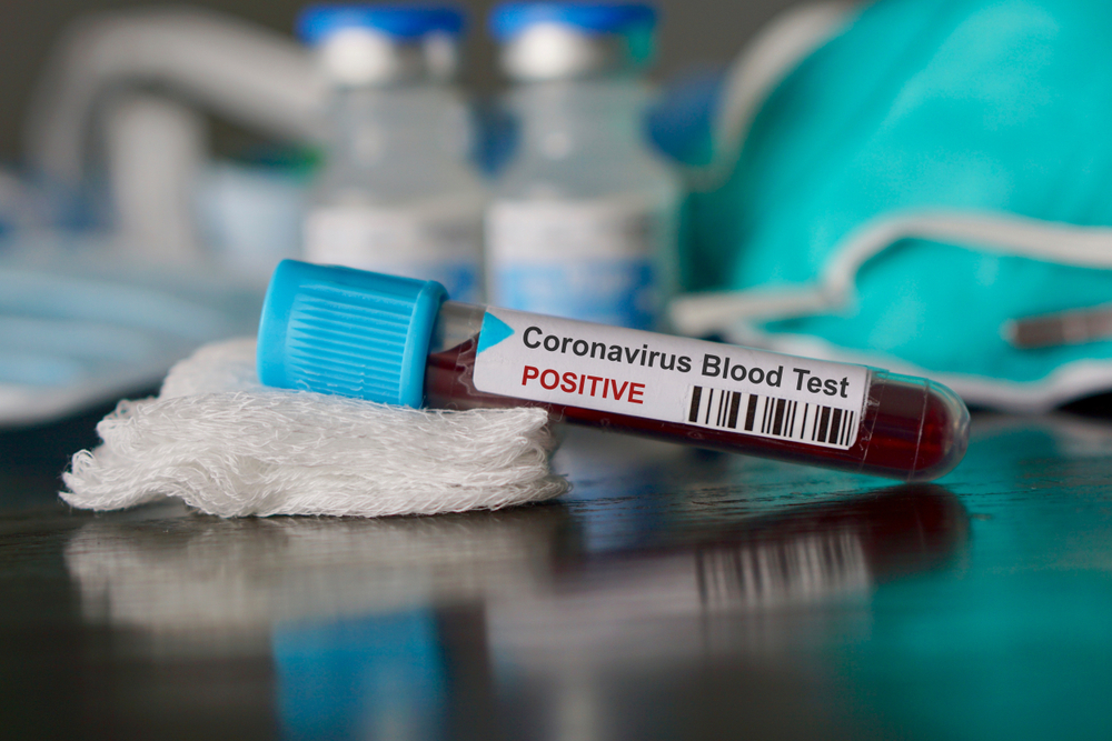 Blood vile from Coronavirus test